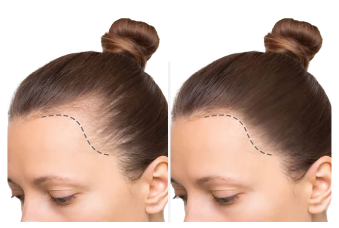 Zamanı Geriye Almak Mümkün